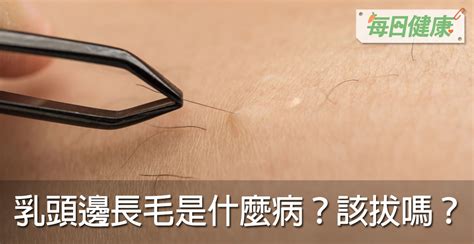 為什麼會長毛|乳頭邊長了毛，是什麼病？該不該拔？讓名醫一次解釋給您聽｜每